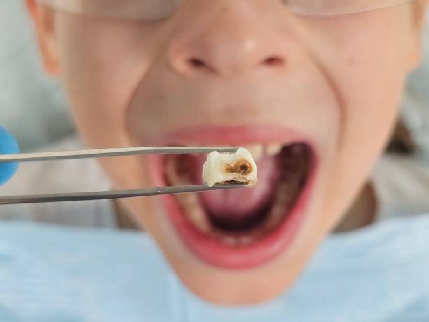 Trusted AR Emergency Dentist Experts